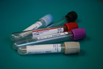 Four empty blood collection vials to represent the article title - My Experience Of The Short Synacthen Test (SST)