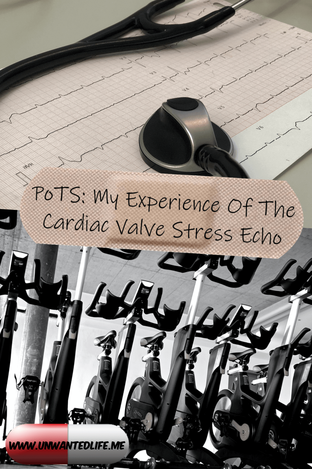 PoTS My Experience Of The Cardiac Valve Stress Echo