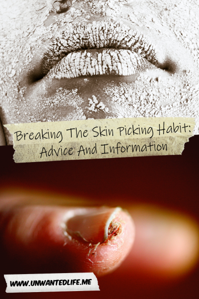 The picture is split in two, with the top image being of a woman's face covered in flaky white paint powder. The bottom image being of a someone's damaged skin around their finger nail. The two images are separated by the article title - Breaking The Skin Picking Habit: Advice And Information